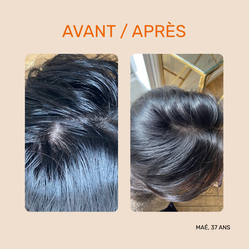 Shampoing végétal "No-poo"  -  Shampoing sec