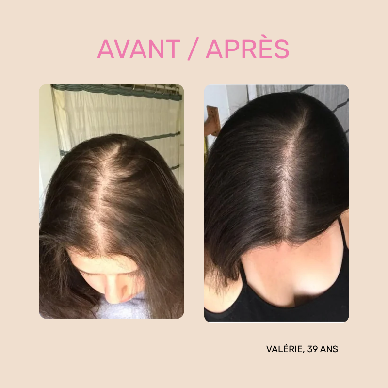 Masque Sublimateur - Recharge Cure Pousse