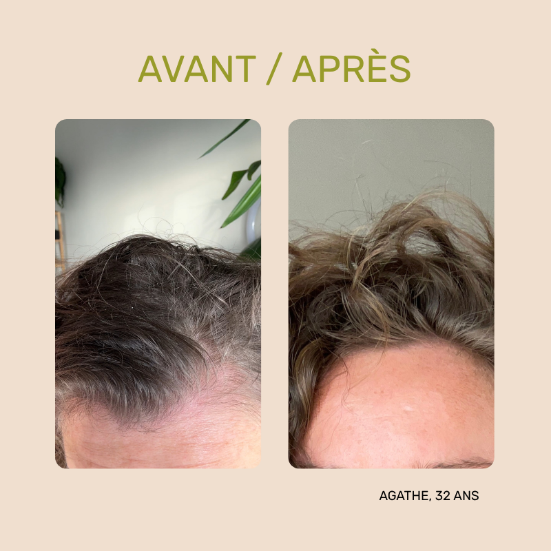 Masque Détox - Recharge Cure Cheveux Gras